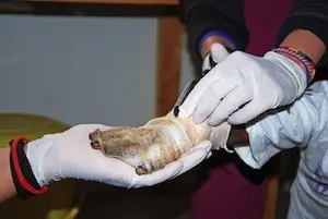 burn injury